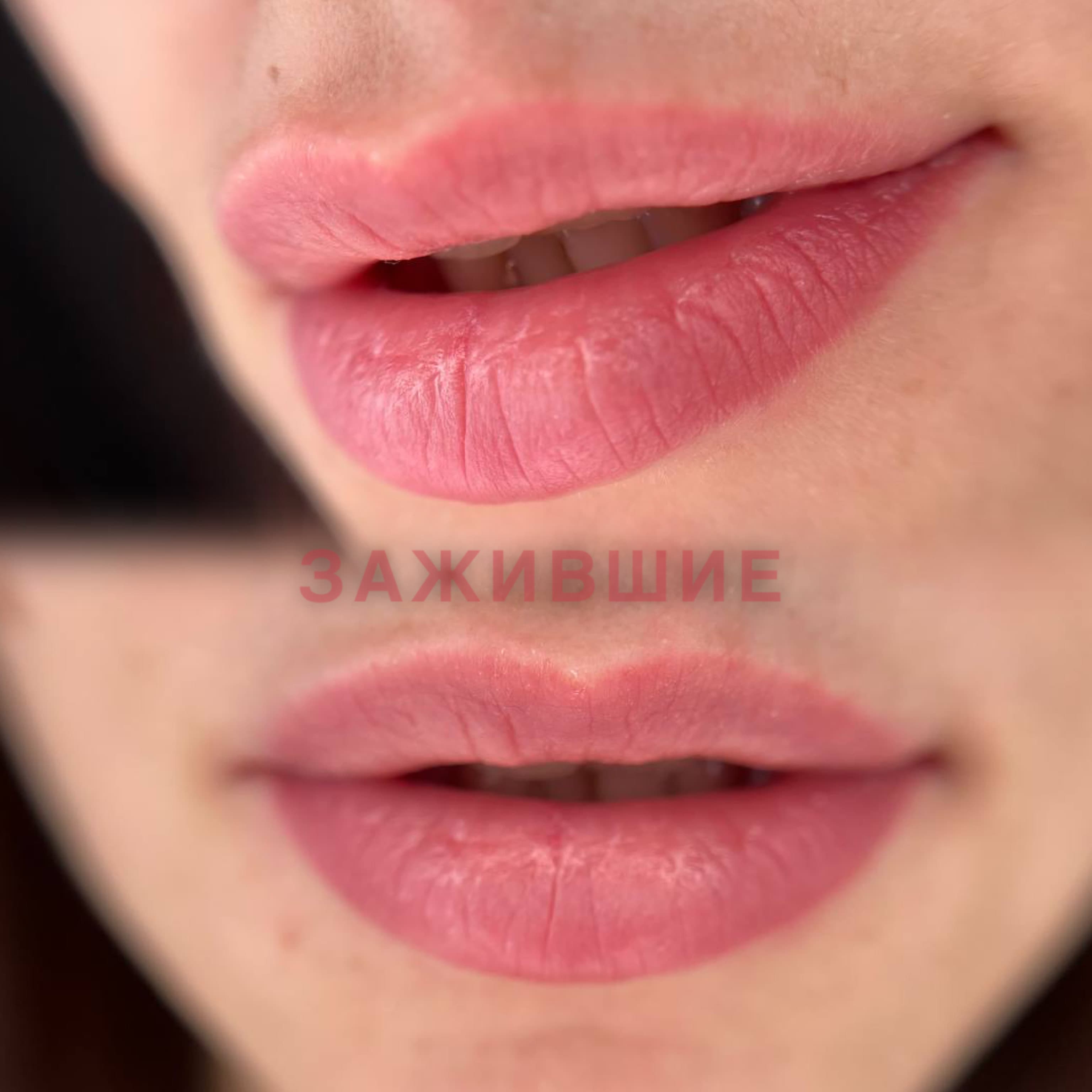 Акварельные губы, зажившие